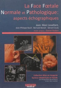 La face foetale normale et pathologique : aspects échographiques