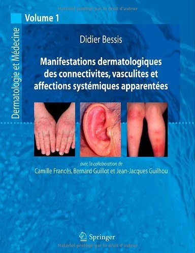 Manifestations Dermatologiques des Connectivites, Vasculites et Affections Systemiques Apparentees.