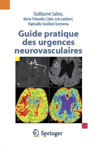 Guide pratique des urgences neurovasculaires