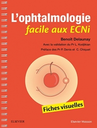 L'ophtalmologie facile aux ECNi: Fiches visuelles
