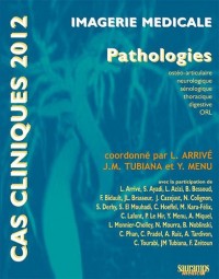 Imagerie médicale : Pathologies