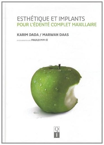 Esthétique et implants pour l'édenté complet maxillaire