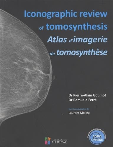 Atlas d'imagerie de tomosynthèse