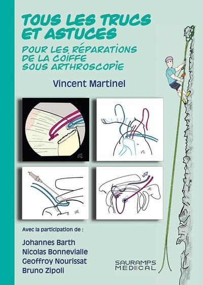 TOUS LES TRUCS ET ASTUCES POUR LES REPARATIONS DE LA COIFFE SOUS ARTHROSCOPIE