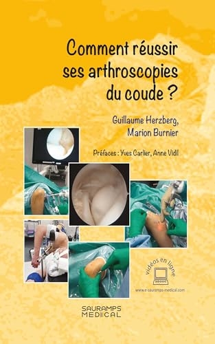 Comment réussir ses arthroscopies du coude ?