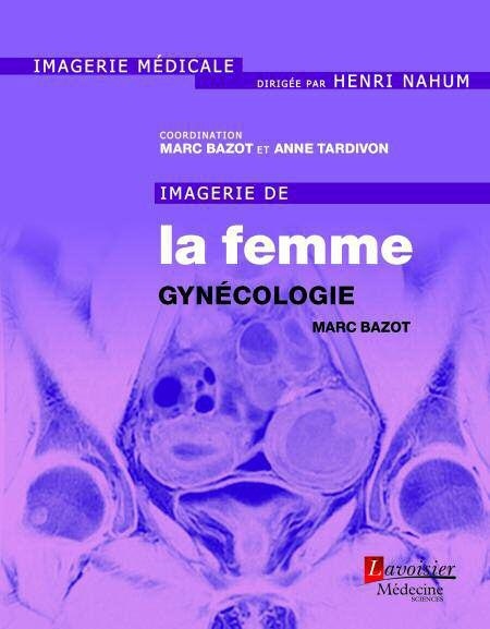 Imagerie de la femme : gynécologie : Tome 1