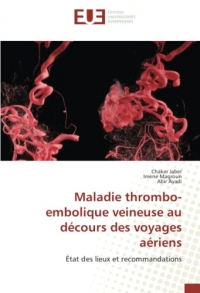 Maladie thrombo-embolique veineuse au décours des voyages aériens: État des lieux et recommandations