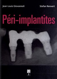 Péri-implantites