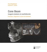 Cone Beam : imagerie dentaire et maxillofaciale : Principes, diagnostic et plan de traitement