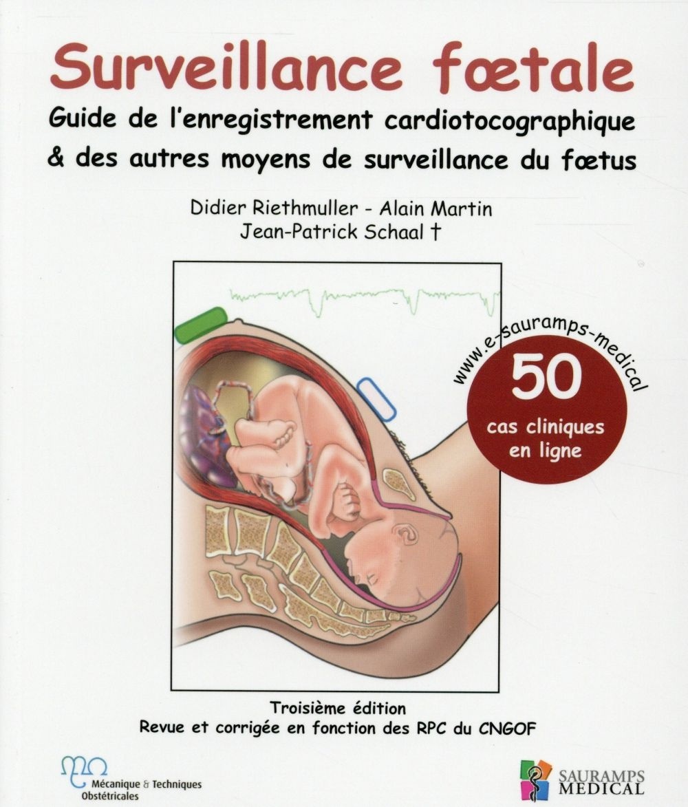Surveillance foetale : Guide de l'enregistrement cardiotocographique & des autres moyens de surveillance du foetus