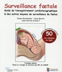 Surveillance foetale : Guide de l'enregistrement cardiotocographique & des autres moyens de surveillance du foetus