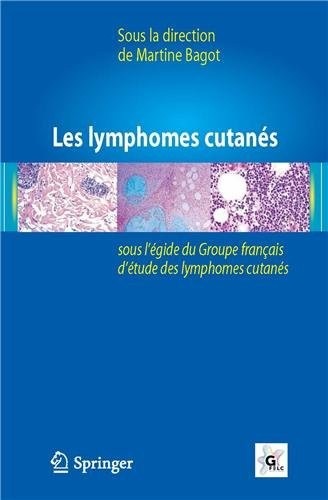 Les lymphomes cutanés