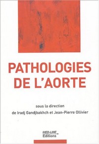 Pathologies de l'aorte