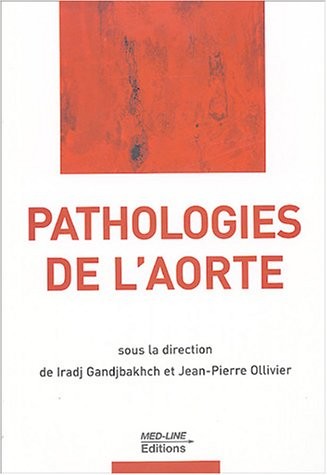 Pathologies de l'aorte