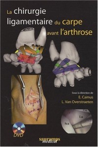 La chirurgie ligamentaire du carpe avant l'arthrose (2DVD)