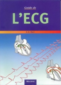 Guide de l'ECG