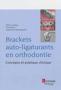 Brackets auto-ligaturants en orthodontie : Concepts et pratique clinique