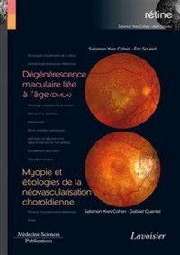 Rétine : Tome 7, Dégénérescence maculaire liée à l'âge (DMLA) ; Myopie et étiologies de la néovascularisation choroïdienne