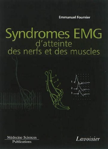 Syndromes EMG d'atteinte des nerfs et des muscles