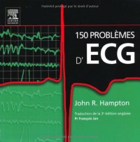 150 problèmes d'ECG (Ancien Prix éditeur : 38 euros)