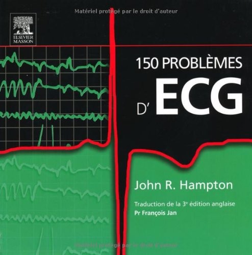 150 problèmes d'ECG (Ancien Prix éditeur : 38 euros)