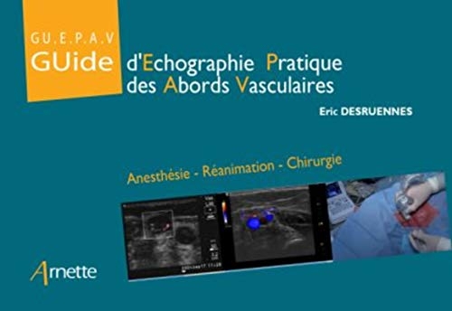 Guide d'échographie pratique des abords vasculaires (GU.E.P.A.V) : Anesthésie - Réanimation - Chirurgie