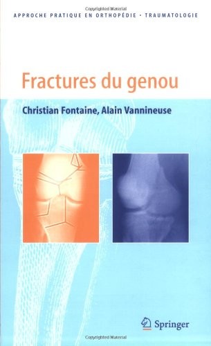 Fractures du genou