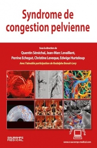 Syndrome de congestion pelvienne