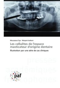 Les cellulites de l'espace masticateur d'origine dentaire: Illustration par une série de cas cliniques