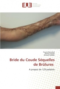 Bride du Coude Séquelles de Brûlures: A propos de 129 patients