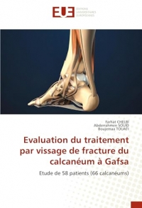Evaluation du traitement par vissage de fracture du calcanéum à Gafsa: Etude de 58 patients (66 calcanéums)