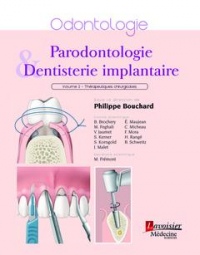 Parodontologie & dentisterie implantaire : Volume 2, Thérapeutiques chirurgicales