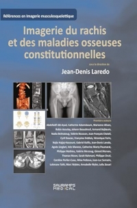 Imagerie du rachis et des maladies osseuses constitutionnelles: Rachis de l'adulte et maladies osseuses de l'enfant vues à l'âge adulte