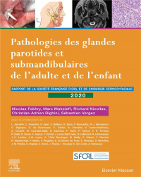 Pathologies des glandes parotides et sous-mandibulaires de l'adulte et de l'enfant: Rapport SFORL 2020