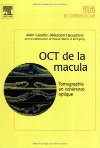 OCT de la macula - Tomographie en cohérence optique dans les maladies de la macula