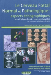 Le cerveau foetal normal et pathologique : aspects échographiques