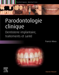 Parodontologie: Maladie Parodontale, Décision Thérapeutique, Traitements, Implantologie