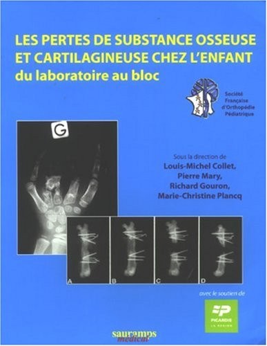Les pertes de substance osseuse et cartilagineuse chez l'enfant : Du laboratoire au bloc