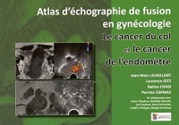 Le cancer du col et le cancer de l'endomètre : Atlas d'échographie fusion en gynécologie