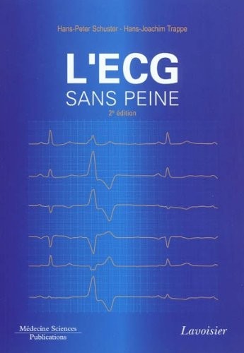 L'ECG sans peine