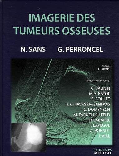 Imagerie des tumeurs osseuses
