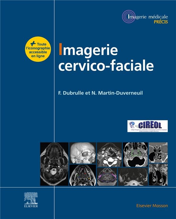 Imagerie cervicofaciale: Massif facial ¿ Sinus ¿ Voies aérodigestives supérieures - Pathologies cervicales ¿ Espaces profonds