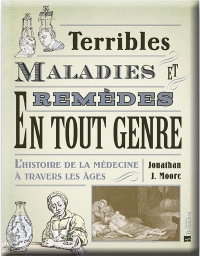 Terribles Maladies et Remèdes en Tout Genre. l'Histoire de la Medecine a Travers les Ages