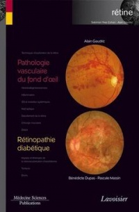 Rétine : Volume 3, Pathologie vasculaire du fond d'oeil ; Rétinopathie diabétique