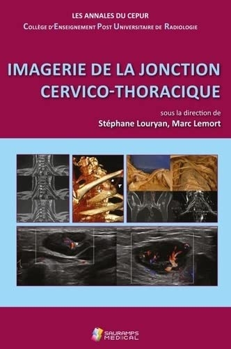 IMAGERIE DE LA JONCTION CERVICO-THORACIQUE: ANNALES DU CEPUR- COLL ENSEIGNEMENT POST-UNIVERSITAIRE DE RADIOLOGIE