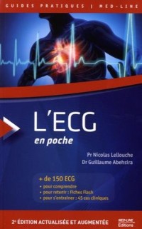 L'ECG en poche