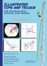 Illustrated tips & tricks for arthroscopic rotator cuff repair