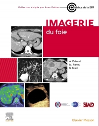 Imagerie Du Foie