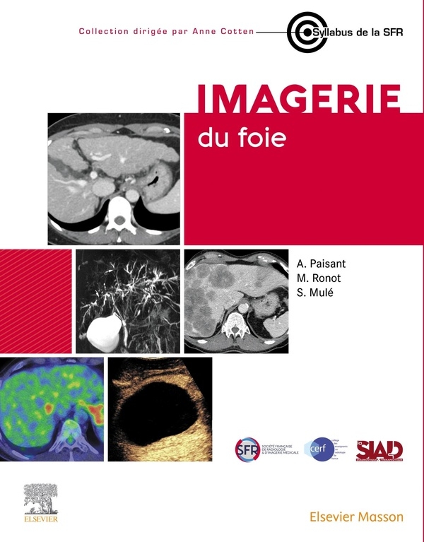 Imagerie Du Foie