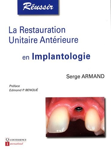La restauration unitaire antérieure en implantologie